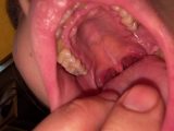大開帳！歯も舌も喉チ○コも全部見てね コトナ① KITR00279
